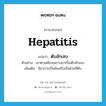 hepatitis แปลว่า?, คำศัพท์ภาษาอังกฤษ hepatitis แปลว่า ตับอักเสบ ประเภท N ตัวอย่าง เขาตาเหลืองเพราะเขาเป็นตับอักเสบ เพิ่มเติม มีอาการเป็นพิษหรือเป็นโรคที่ตับ หมวด N