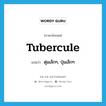 tubercule แปลว่า?, คำศัพท์ภาษาอังกฤษ tubercule แปลว่า ตุ่มเล็กๆ, ปุ่มเล็กๆ ประเภท N หมวด N