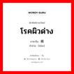 โรคผิวด่าง ภาษาจีนคืออะไร, คำศัพท์ภาษาไทย - จีน โรคผิวด่าง ภาษาจีน 癜 คำอ่าน [diàn]