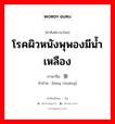 โรคผิวหนังพุพองมีน้ำเหลือง ภาษาจีนคืออะไร, คำศัพท์ภาษาไทย - จีน โรคผิวหนังพุพองมีน้ำเหลือง ภาษาจีน 狼疮 คำอ่าน [láng chuāng]