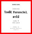 โรคฝี( furuncle), ตาไม้ ภาษาจีนคืออะไร, คำศัพท์ภาษาไทย - จีน โรคฝี( furuncle), ตาไม้ ภาษาจีน 疖子 คำอ่าน [jiē zǐ]