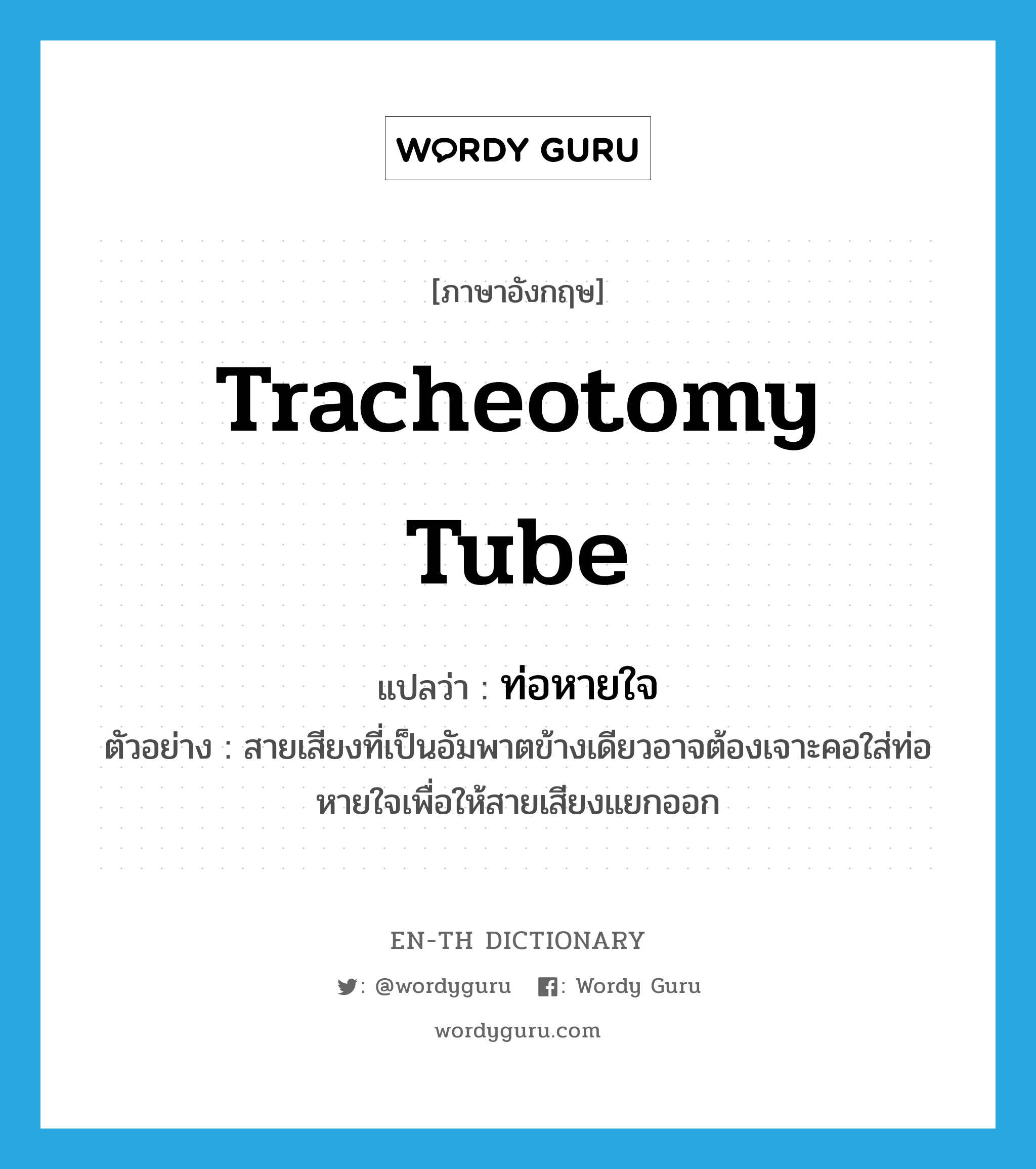 tracheotomy tube แปลว่า?, คำศัพท์ภาษาอังกฤษ tracheotomy tube แปลว่า ท่อหายใจ ประเภท N ตัวอย่าง สายเสียงที่เป็นอัมพาตข้างเดียวอาจต้องเจาะคอใส่ท่อหายใจเพื่อให้สายเสียงแยกออก หมวด N