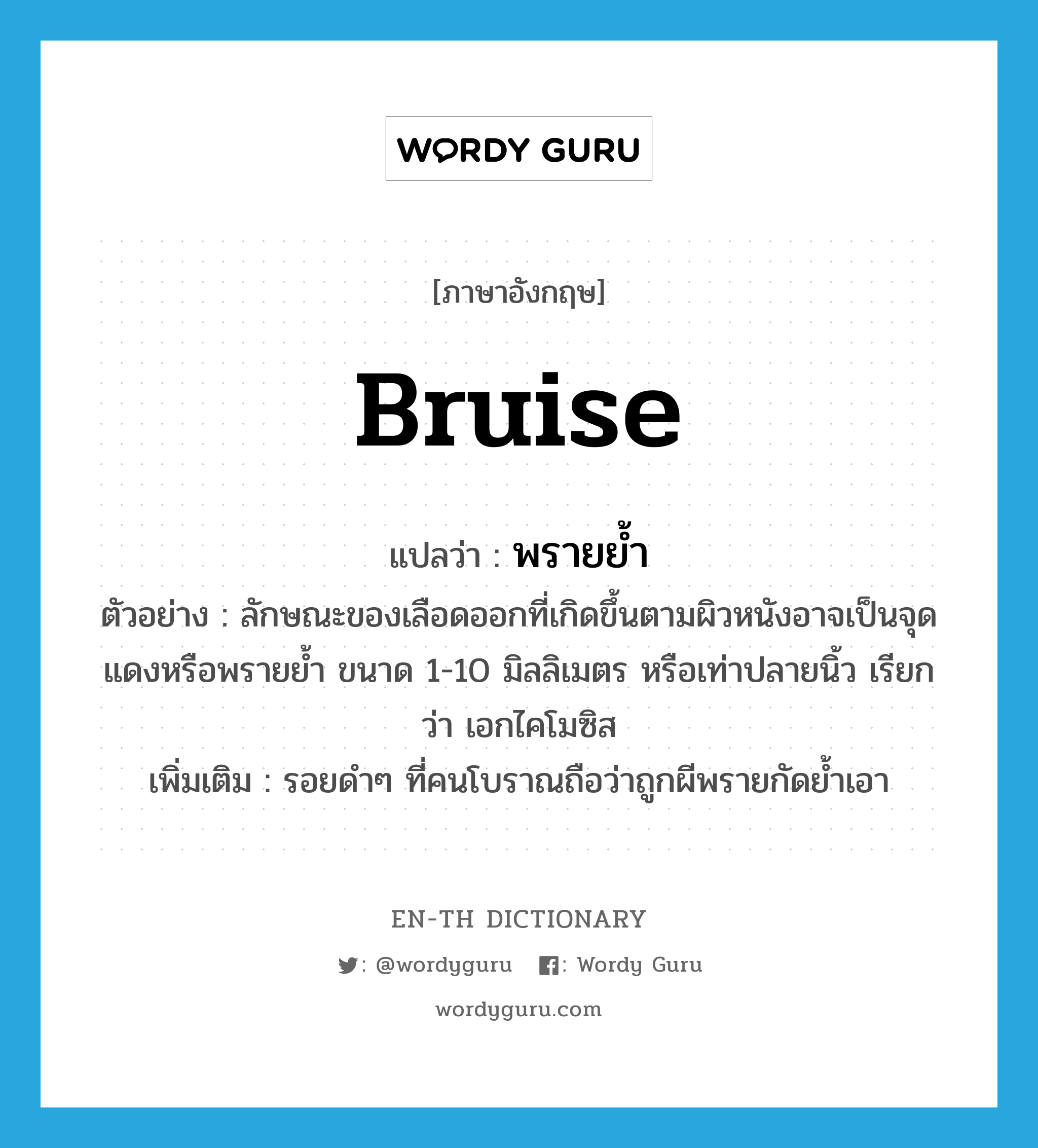 bruise แปลว่า?, คำศัพท์ภาษาอังกฤษ bruise แปลว่า พรายย้ำ ประเภท N ตัวอย่าง ลักษณะของเลือดออกที่เกิดขึ้นตามผิวหนังอาจเป็นจุดแดงหรือพรายย้ำ ขนาด 1-10 มิลลิเมตร หรือเท่าปลายนิ้ว เรียกว่า เอกไคโมซิส เพิ่มเติม รอยดำๆ ที่คนโบราณถือว่าถูกผีพรายกัดย้ำเอา หมวด N