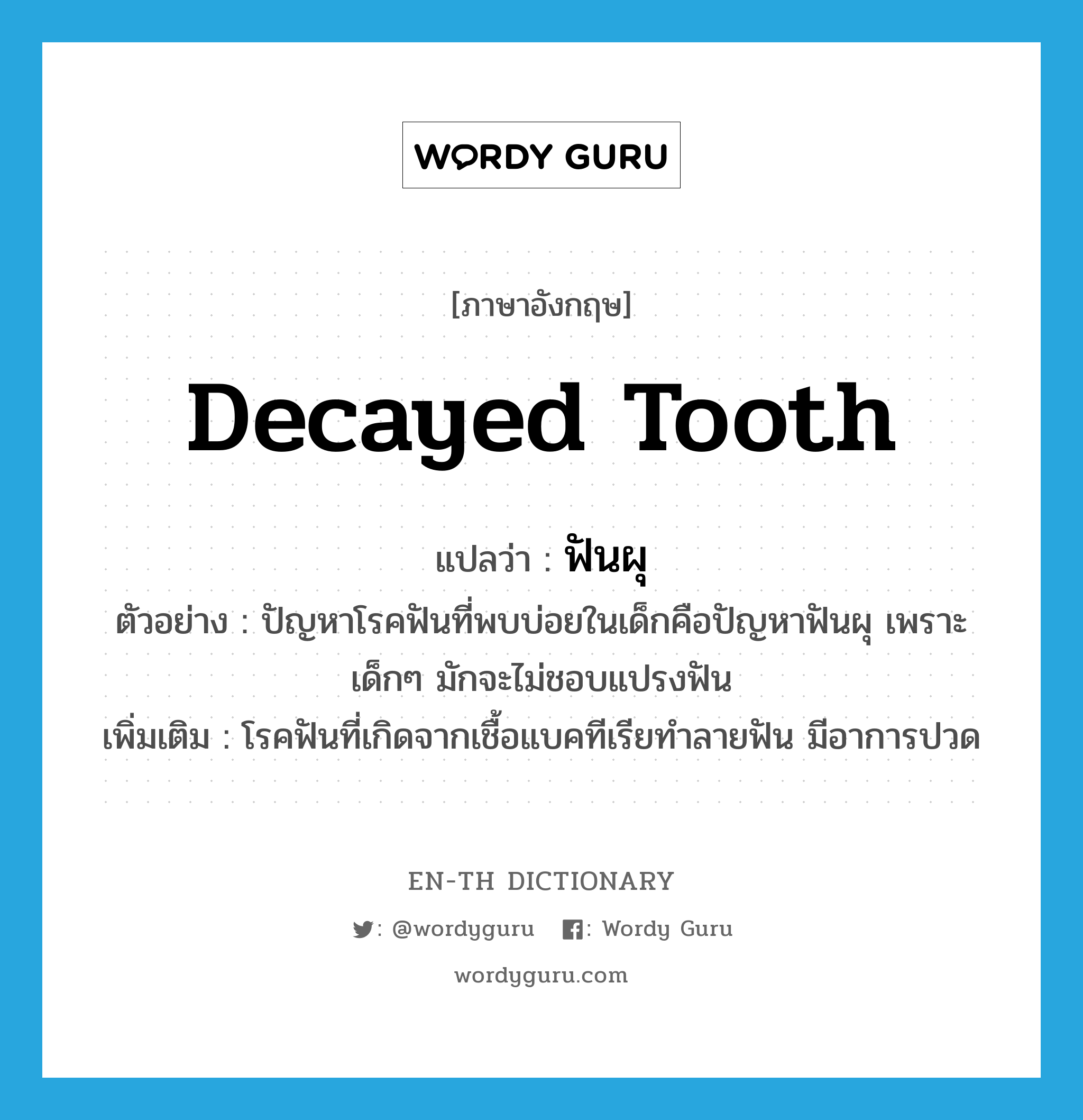 &#34;ฟันผุ&#34; (N), คำศัพท์ภาษาอังกฤษ ฟันผุ แปลว่า decayed tooth ประเภท N ตัวอย่าง ปัญหาโรคฟันที่พบบ่อยในเด็กคือปัญหาฟันผุ เพราะเด็กๆ มักจะไม่ชอบแปรงฟัน เพิ่มเติม โรคฟันที่เกิดจากเชื้อแบคทีเรียทำลายฟัน มีอาการปวด หมวด N