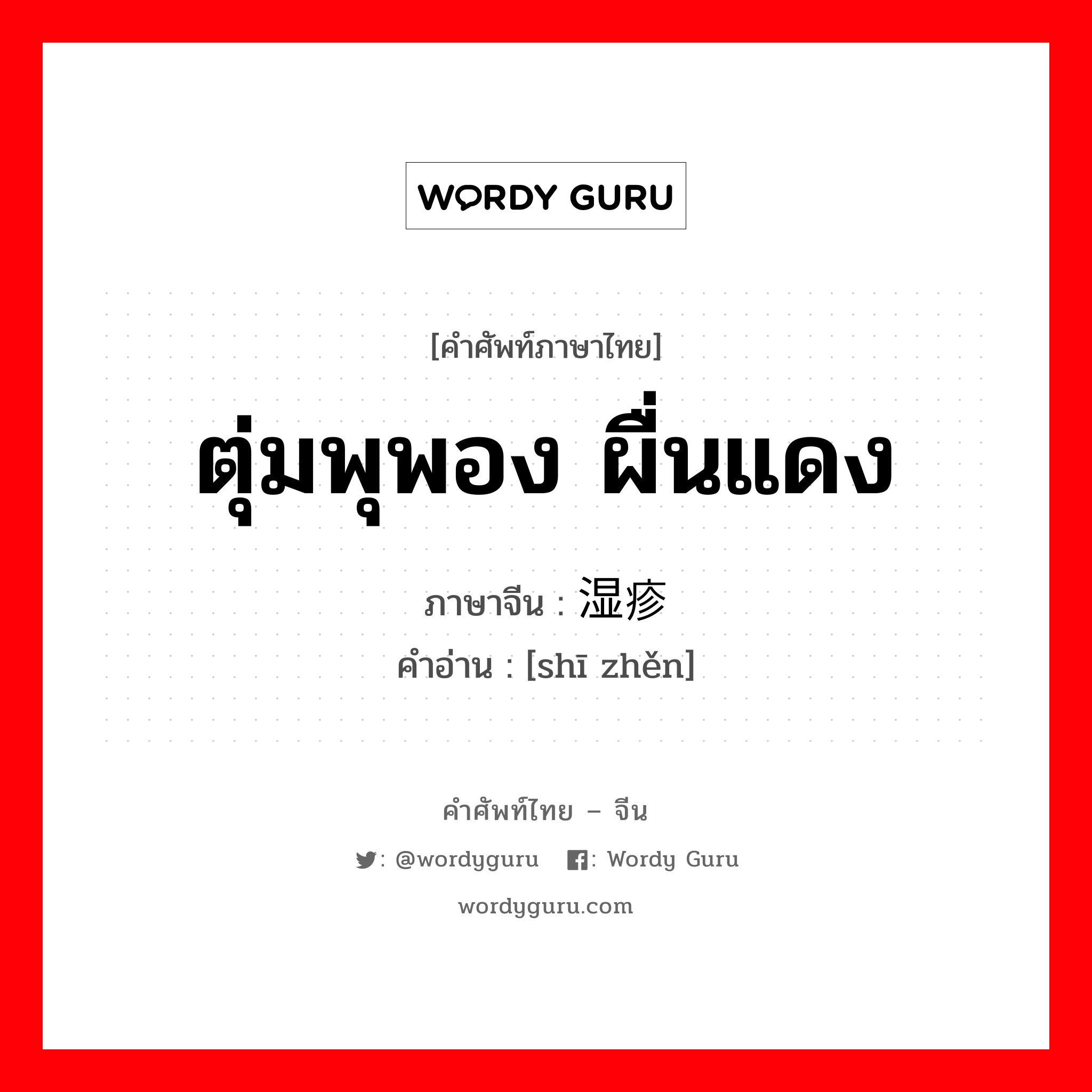 ตุ่มพุพอง ผื่นแดง ภาษาจีนคืออะไร, คำศัพท์ภาษาไทย - จีน ตุ่มพุพอง ผื่นแดง ภาษาจีน 湿疹 คำอ่าน [shī zhěn]