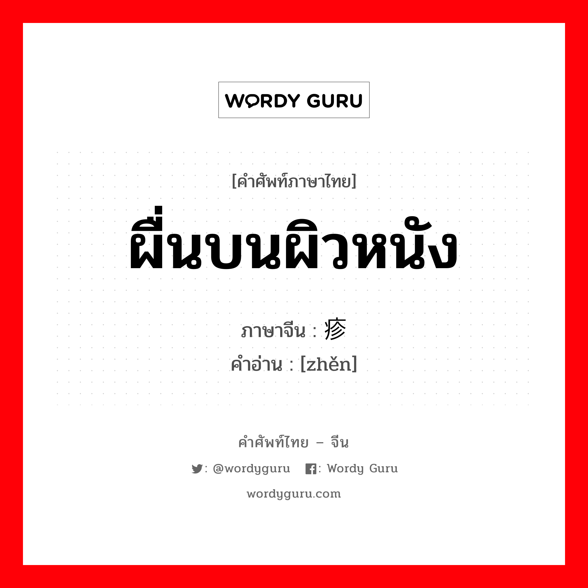 ผื่นบนผิวหนัง ภาษาจีนคืออะไร, คำศัพท์ภาษาไทย - จีน ผื่นบนผิวหนัง ภาษาจีน 疹 คำอ่าน [zhěn]