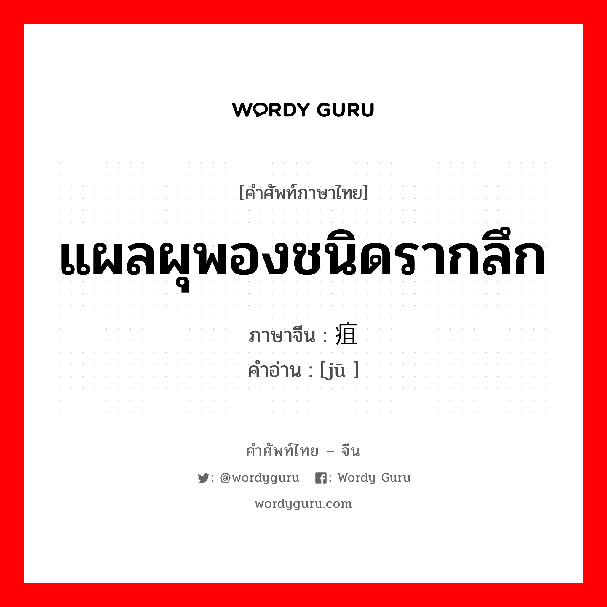 แผลผุพองชนิดรากลึก ภาษาจีนคืออะไร, คำศัพท์ภาษาไทย - จีน แผลผุพองชนิดรากลึก ภาษาจีน 疽 คำอ่าน [jū ]