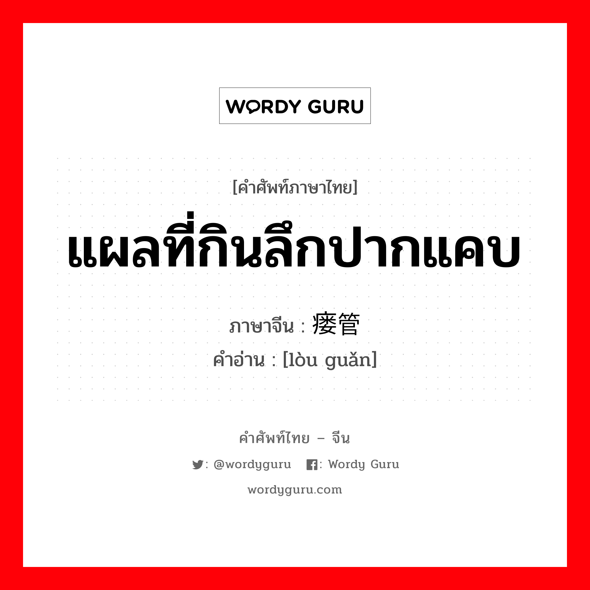 แผลที่กินลึกปากแคบ ภาษาจีนคืออะไร, คำศัพท์ภาษาไทย - จีน แผลที่กินลึกปากแคบ ภาษาจีน 瘘管 คำอ่าน [lòu guǎn]