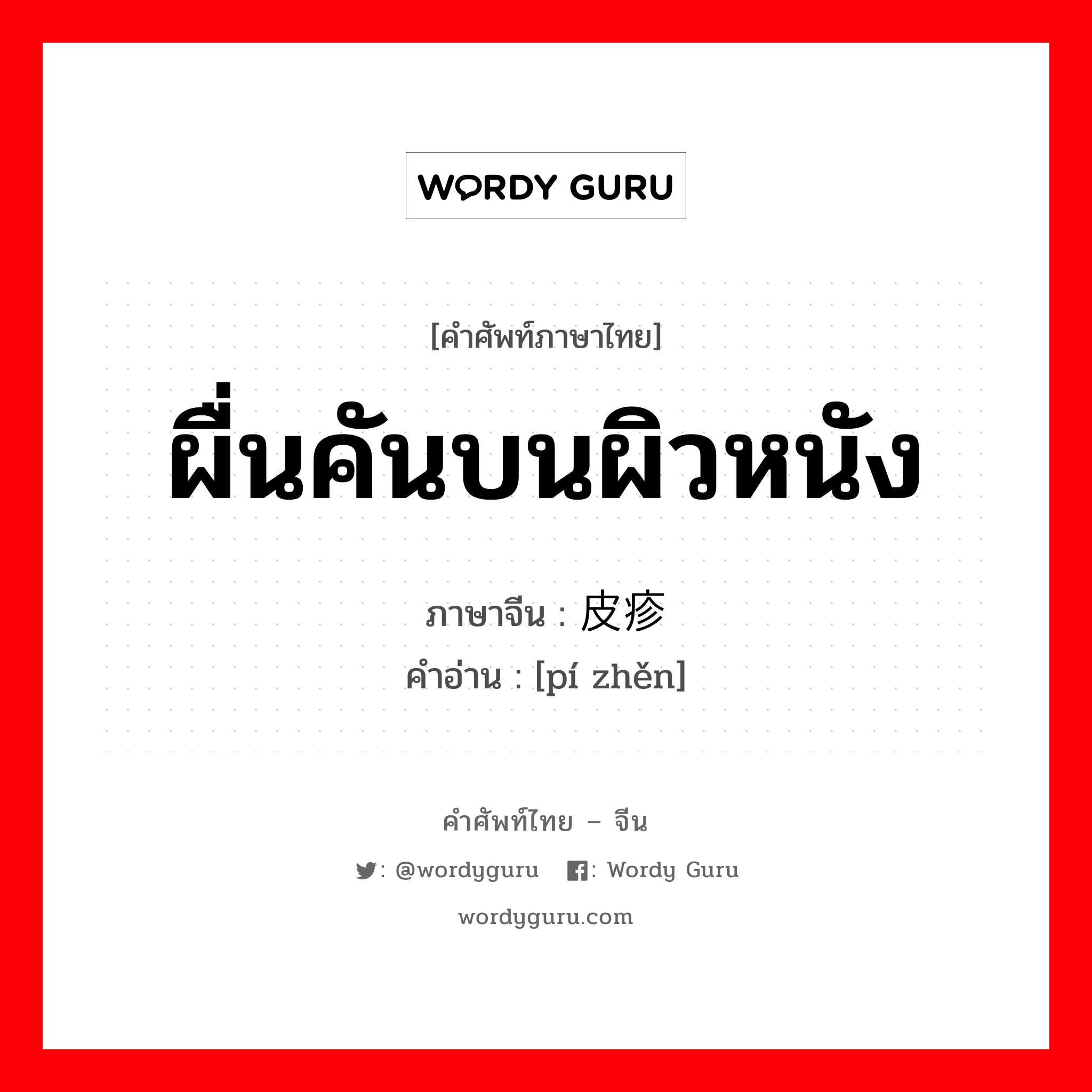 ผื่นคันบนผิวหนัง ภาษาจีนคืออะไร, คำศัพท์ภาษาไทย - จีน ผื่นคันบนผิวหนัง ภาษาจีน 皮疹 คำอ่าน [pí zhěn]