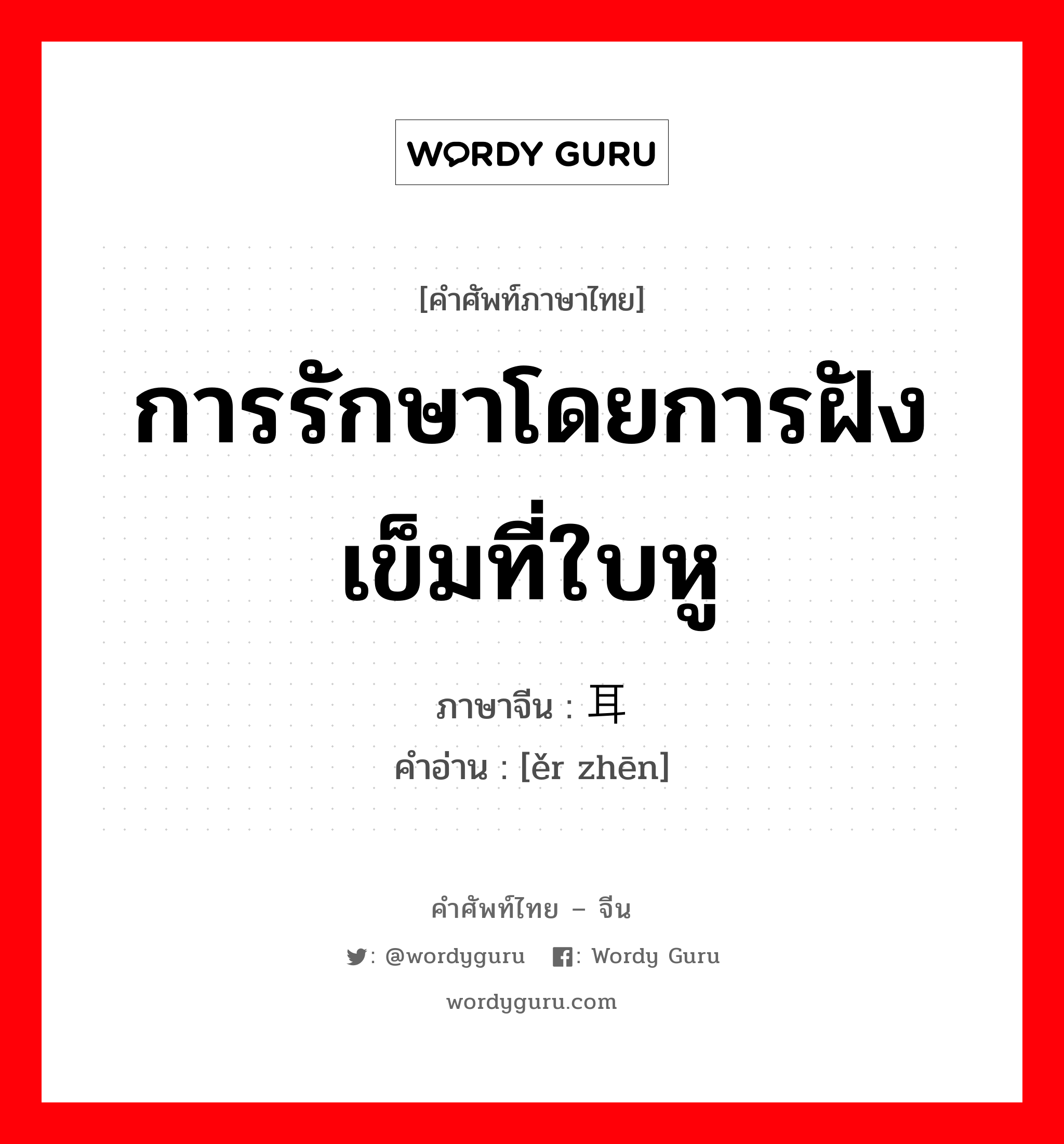 การรักษาโดยการฝังเข็มที่ใบหู ภาษาจีนคืออะไร, คำศัพท์ภาษาไทย - จีน การรักษาโดยการฝังเข็มที่ใบหู ภาษาจีน 耳针 คำอ่าน [ěr zhēn]