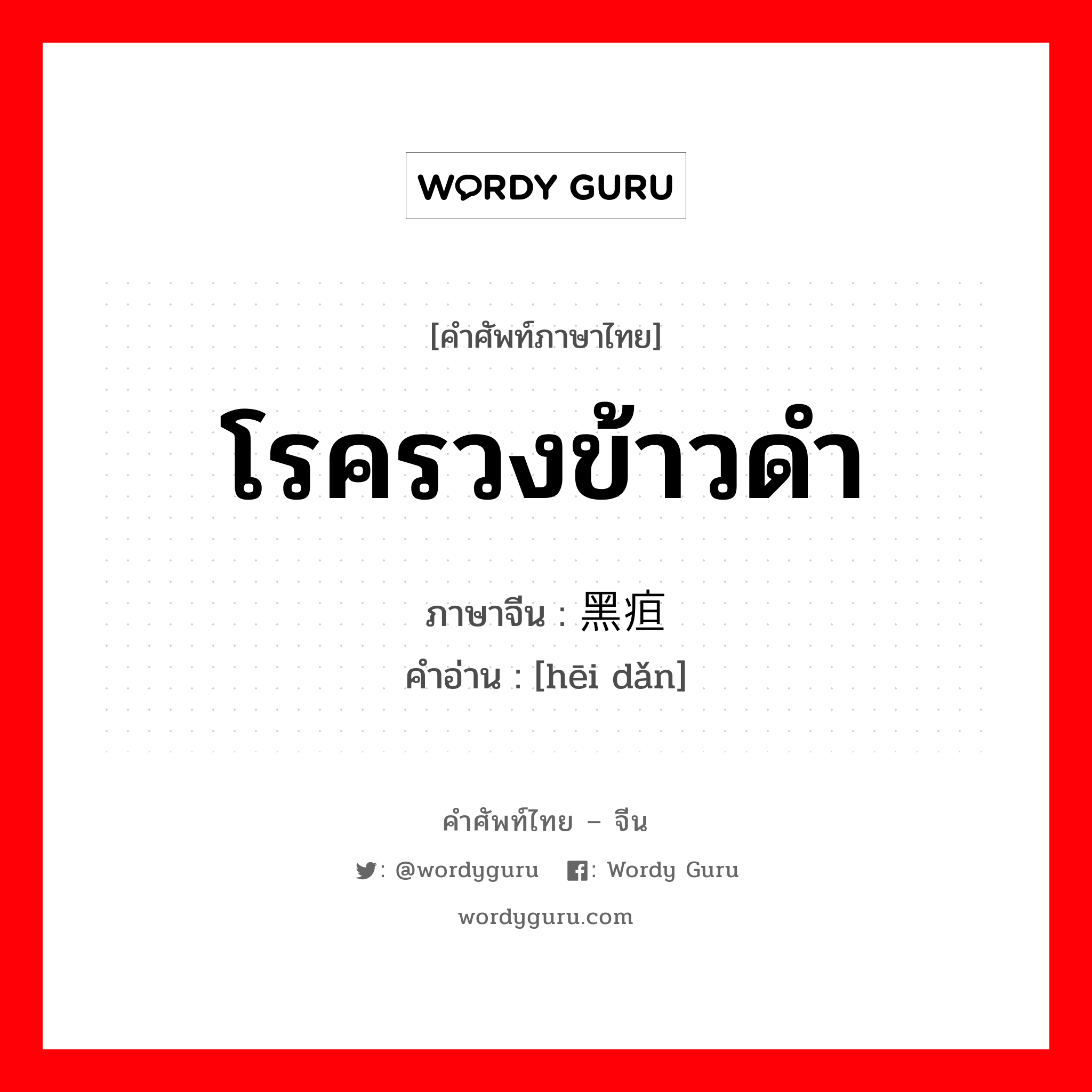 โรครวงข้าวดำ ภาษาจีนคืออะไร, คำศัพท์ภาษาไทย - จีน โรครวงข้าวดำ ภาษาจีน 黑疸 คำอ่าน [hēi dǎn]