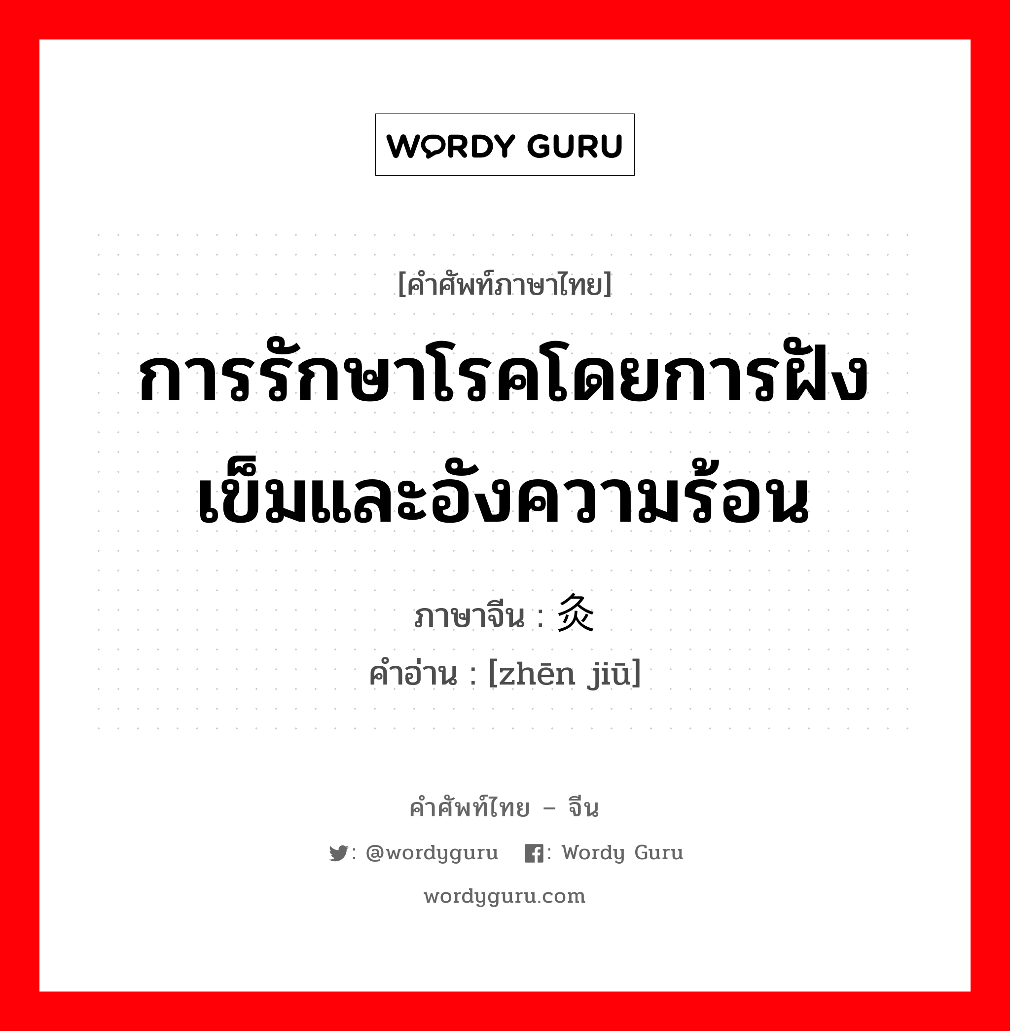 การรักษาโรคโดยการฝังเข็มและอังความร้อน ภาษาจีนคืออะไร, คำศัพท์ภาษาไทย - จีน การรักษาโรคโดยการฝังเข็มและอังความร้อน ภาษาจีน 针灸 คำอ่าน [zhēn jiū]