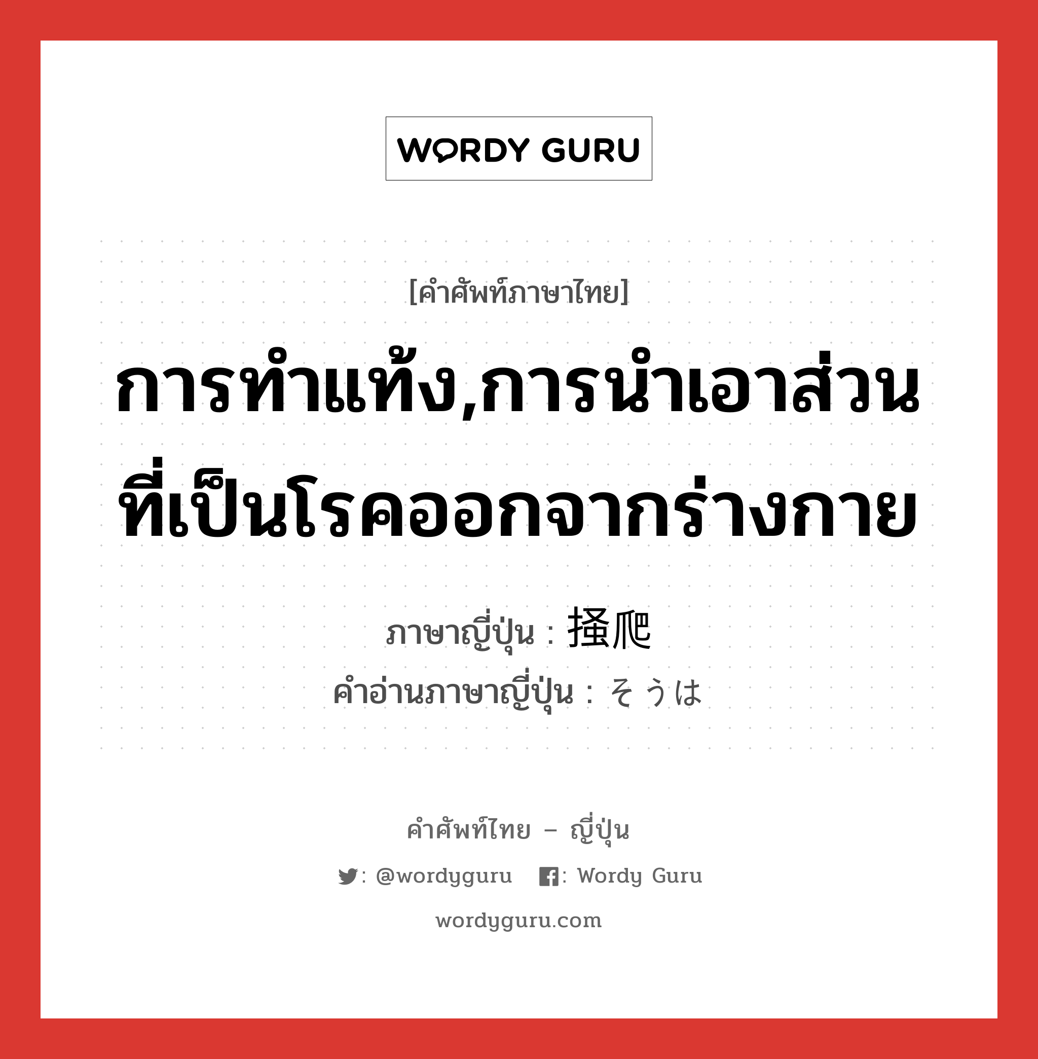 การทำแท้ง,การนำเอาส่วนที่เป็นโรคออกจากร่างกาย ภาษาญี่ปุ่นคืออะไร, คำศัพท์ภาษาไทย - ญี่ปุ่น การทำแท้ง,การนำเอาส่วนที่เป็นโรคออกจากร่างกาย ภาษาญี่ปุ่น 掻爬 คำอ่านภาษาญี่ปุ่น そうは หมวด n หมวด n