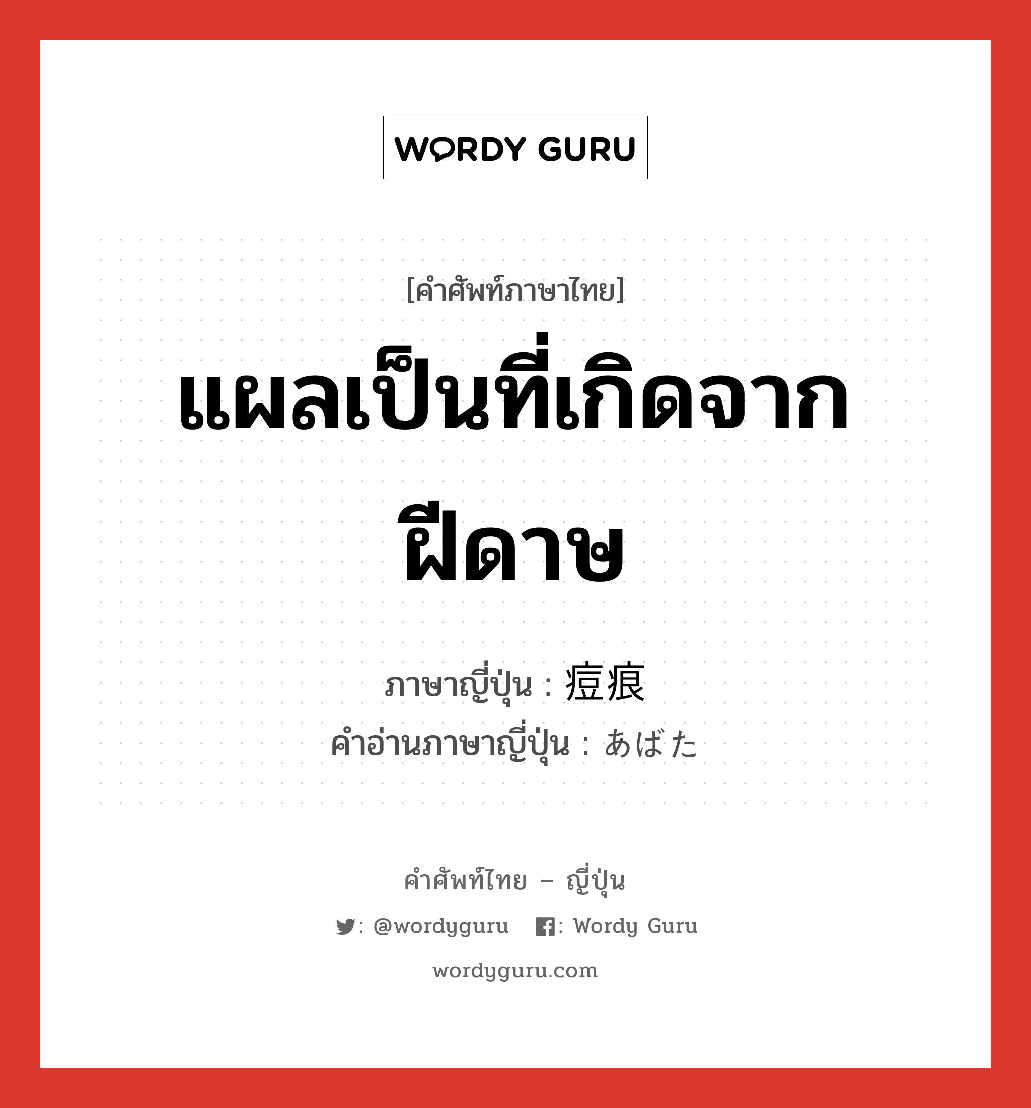 แผลเป็นที่เกิดจากฝีดาษ ภาษาญี่ปุ่นคืออะไร, คำศัพท์ภาษาไทย - ญี่ปุ่น แผลเป็นที่เกิดจากฝีดาษ ภาษาญี่ปุ่น 痘痕 คำอ่านภาษาญี่ปุ่น あばた หมวด n หมวด n