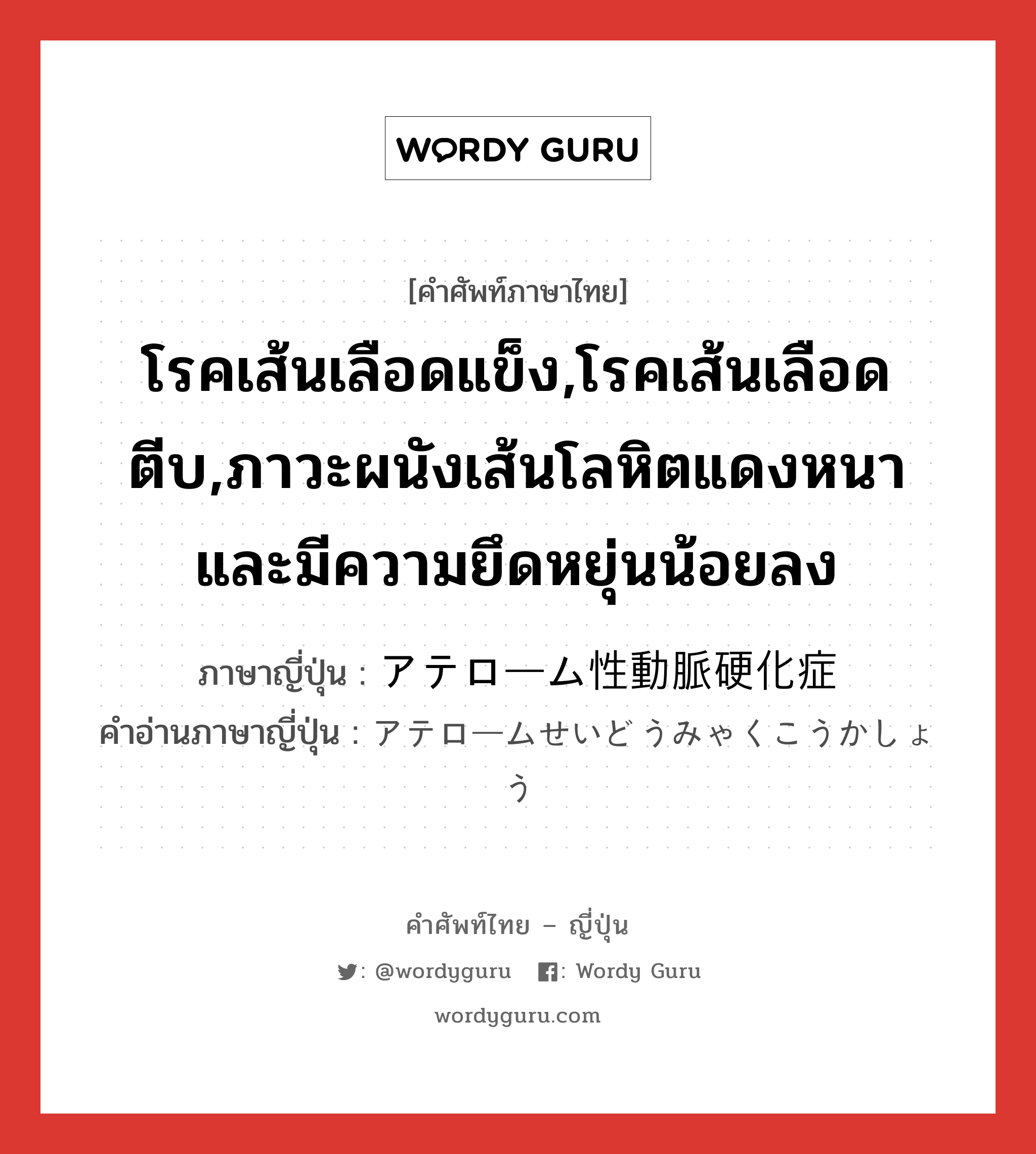 โรคเส้นเลือดแข็ง,โรคเส้นเลือดตีบ,ภาวะผนังเส้นโลหิตแดงหนาและมีความยึดหยุ่นน้อยลง ภาษาญี่ปุ่นคืออะไร, คำศัพท์ภาษาไทย - ญี่ปุ่น โรคเส้นเลือดแข็ง,โรคเส้นเลือดตีบ,ภาวะผนังเส้นโลหิตแดงหนาและมีความยึดหยุ่นน้อยลง ภาษาญี่ปุ่น アテローム性動脈硬化症 คำอ่านภาษาญี่ปุ่น アテロームせいどうみゃくこうかしょう หมวด n หมวด n