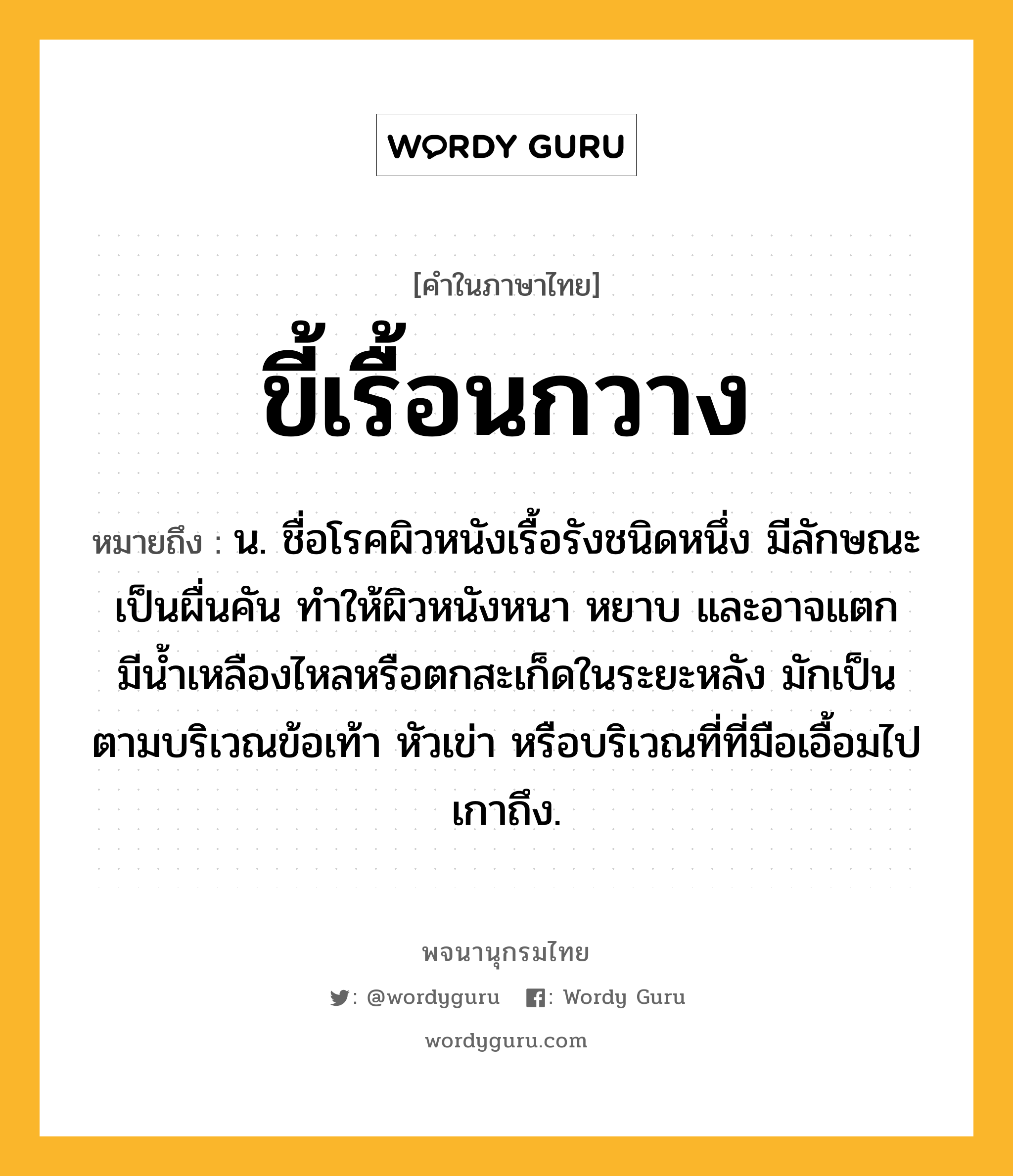 ขี้เรื้อนกวาง หมายถึงอะไร?, คำในภาษาไทย ขี้เรื้อนกวาง หมายถึง น. ชื่อโรคผิวหนังเรื้อรังชนิดหนึ่ง มีลักษณะเป็นผื่นคัน ทําให้ผิวหนังหนา หยาบ และอาจแตกมีนํ้าเหลืองไหลหรือตกสะเก็ดในระยะหลัง มักเป็นตามบริเวณข้อเท้า หัวเข่า หรือบริเวณที่ที่มือเอื้อมไปเกาถึง.