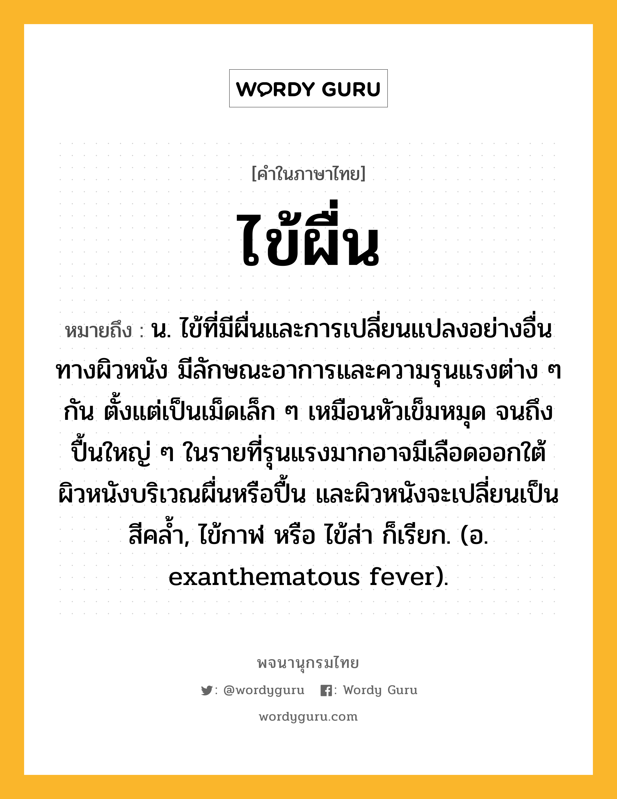 ไข้ผื่น หมายถึงอะไร?, คำในภาษาไทย ไข้ผื่น หมายถึง น. ไข้ที่มีผื่นและการเปลี่ยนแปลงอย่างอื่นทางผิวหนัง มีลักษณะอาการและความรุนแรงต่าง ๆ กัน ตั้งแต่เป็นเม็ดเล็ก ๆ เหมือนหัวเข็มหมุด จนถึงปื้นใหญ่ ๆ ในรายที่รุนแรงมากอาจมีเลือดออกใต้ผิวหนังบริเวณผื่นหรือปื้น และผิวหนังจะเปลี่ยนเป็นสีคล้ำ, ไข้กาฬ หรือ ไข้ส่า ก็เรียก. (อ. exanthematous fever).