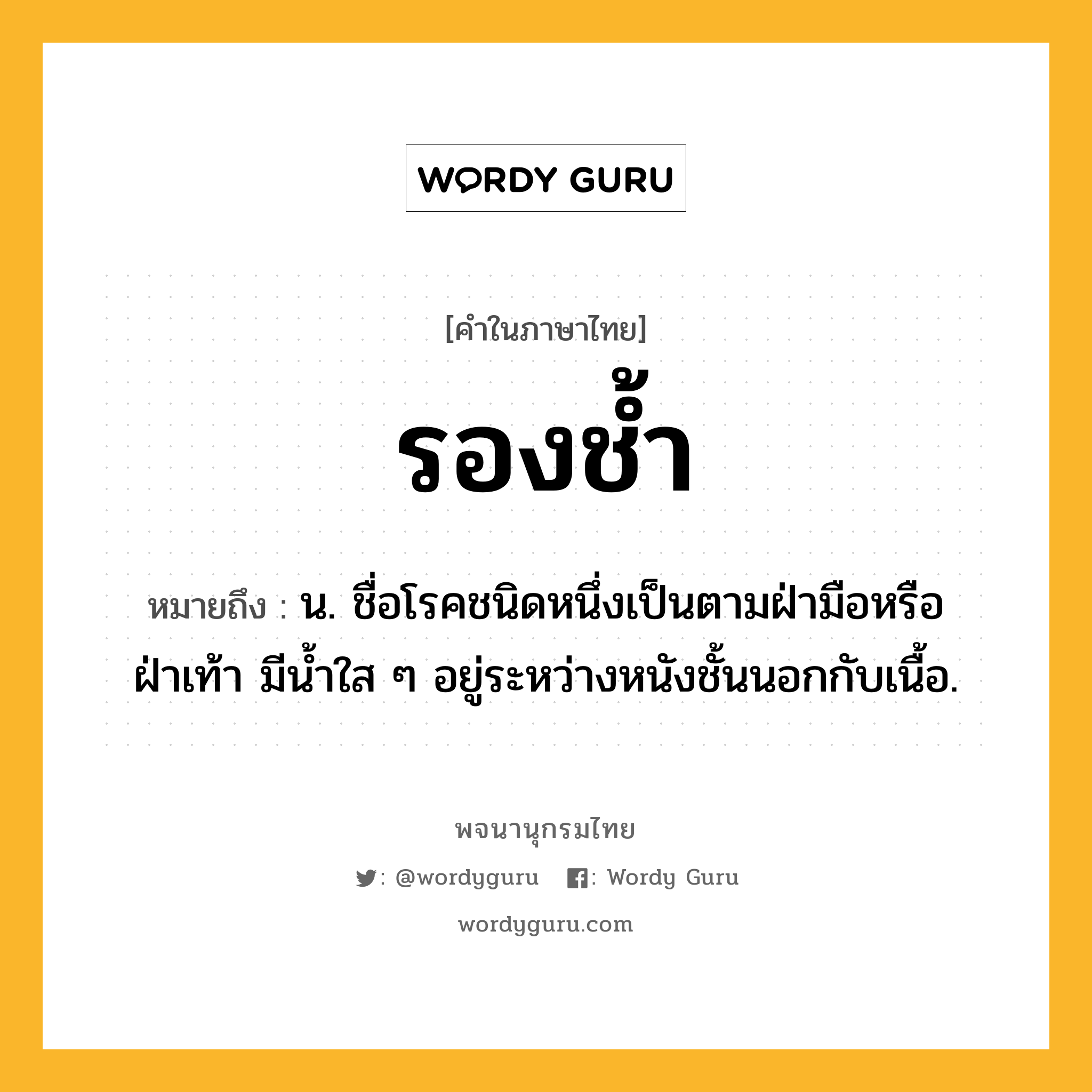 รองช้ำ หมายถึงอะไร?, คำในภาษาไทย รองช้ำ หมายถึง น. ชื่อโรคชนิดหนึ่งเป็นตามฝ่ามือหรือฝ่าเท้า มีนํ้าใส ๆ อยู่ระหว่างหนังชั้นนอกกับเนื้อ.