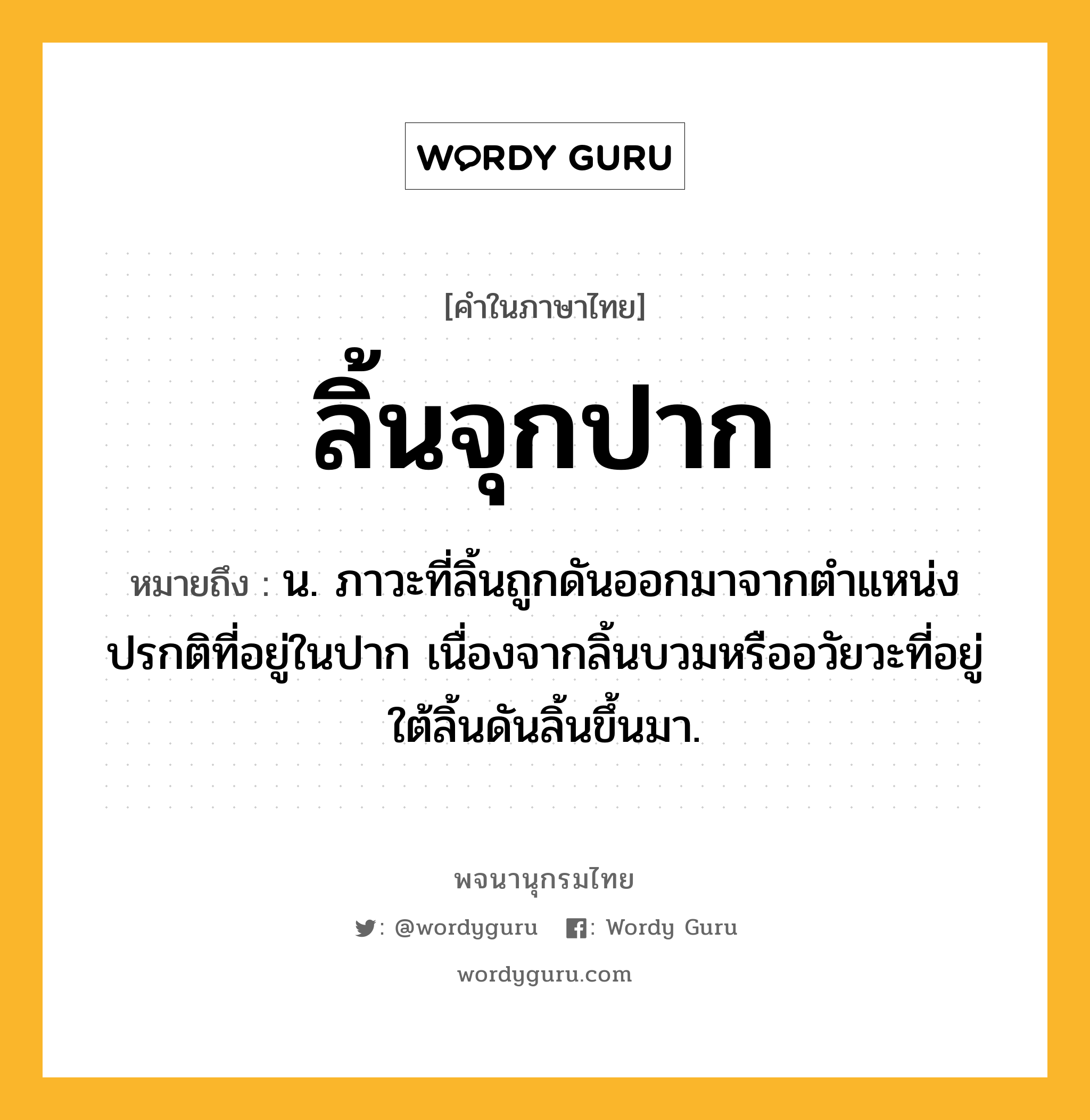 ลิ้นจุกปาก หมายถึงอะไร?, คำในภาษาไทย ลิ้นจุกปาก หมายถึง น. ภาวะที่ลิ้นถูกดันออกมาจากตำแหน่งปรกติที่อยู่ในปาก เนื่องจากลิ้นบวมหรืออวัยวะที่อยู่ใต้ลิ้นดันลิ้นขึ้นมา.